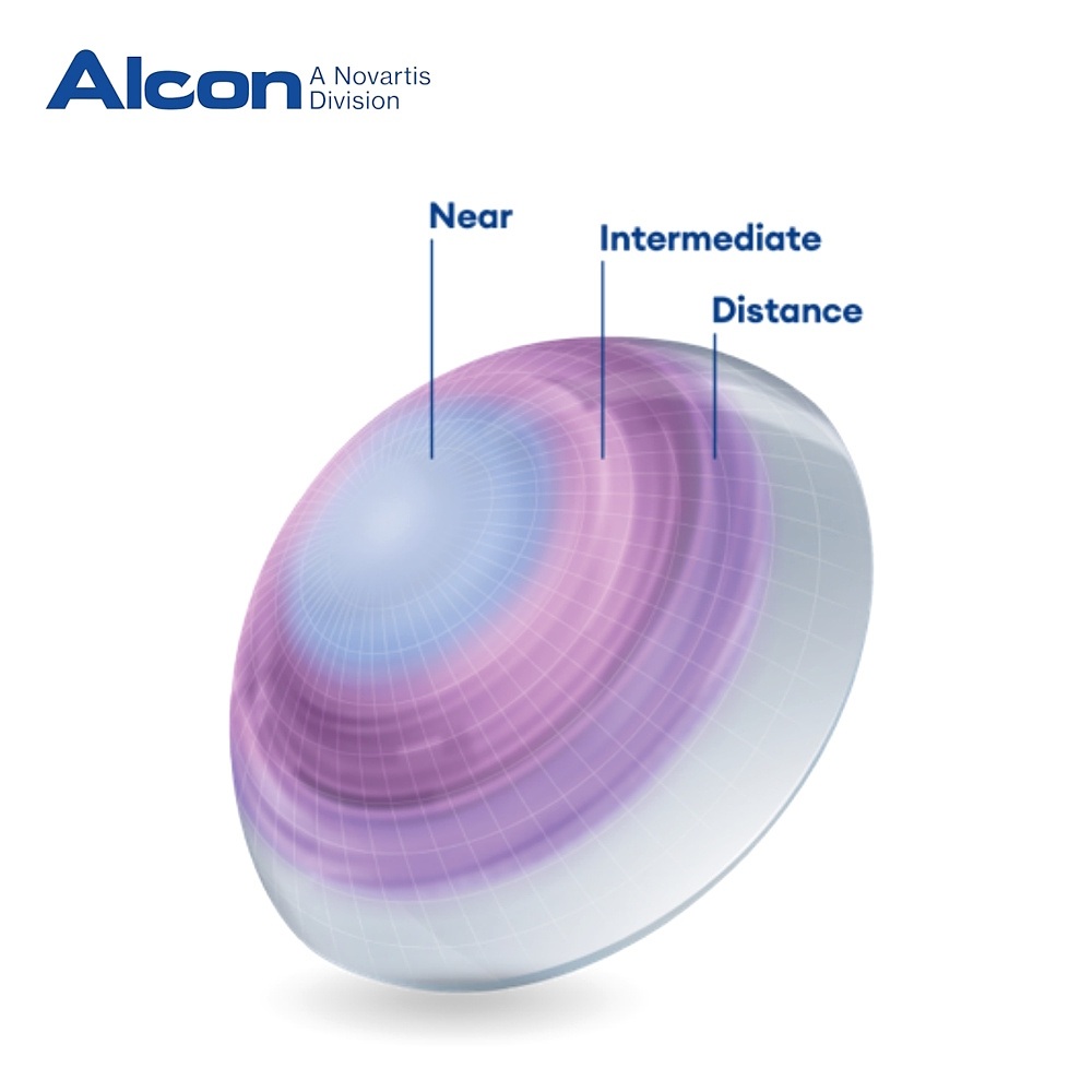 Alcon TOTAL30 Multifocal Monthly Contact Lenses Alcon TOTAL30 Multifocal Monthly Contact Lenses